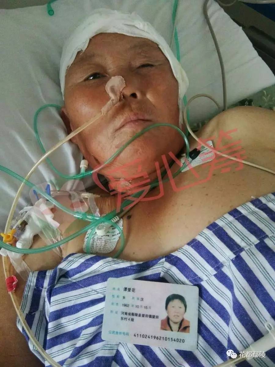 52歲婦女抽血漿后腦梗死，家屬發(fā)聲揭示真相！