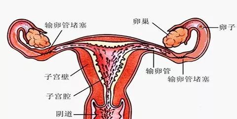 女子便秘20年腹中取出巨型結(jié)腸，深度解析背后的健康警示與生活反思