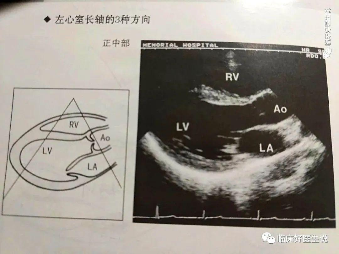 哀痛之下，女子遭遇心碎綜合征——關于愛與失去的深刻剖析